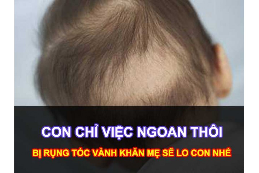 Giải pháp cỉa thiện Hiện tượng rụng tóc ở trẻ sơ sinh (Rụng tóc máu và rụng tóc vành khăn