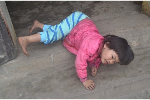 Chế độ ăn uống cho người bệnh động kinh