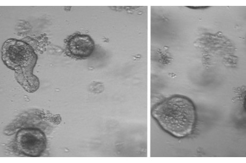 Không cần tiêm tế bào gốc đắt đỏ, chỉ cần nhịn ăn đúng cách là có thể "trẻ mãi không già".