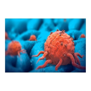 Phát Đồ Khối U 1