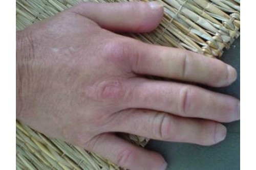 Tôi muốn da đẹp 